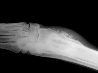 Radiograph